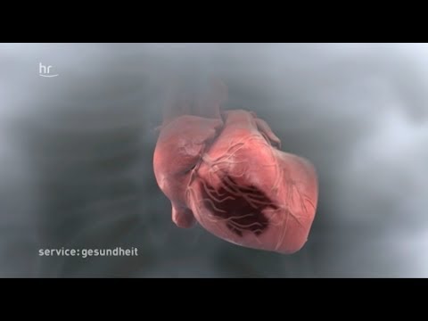 Kartoffeltriebe behandelt Gelenke Bewertungen Schmerzen in mehreren Gelenken