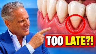 ARE YOUR GUMS BLEEDING? DO THIS BEFORE ITS TOO LATE