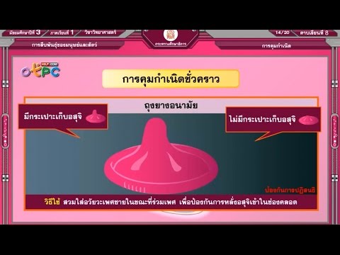 รากฟันเทียมสำหรับ Natrelle เต้านม สาวน้อยที่มีหน้าอกธรรมชาติขนาดใหญ่