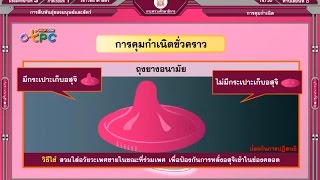 สื่อการเรียนการสอน การคุมกำเนิดม.3วิทยาศาสตร์