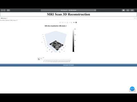 MRI Scan 3D Reconstruction using Computer Vision