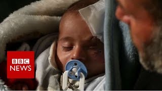Race to rescue injured Syrian baby - BBC News