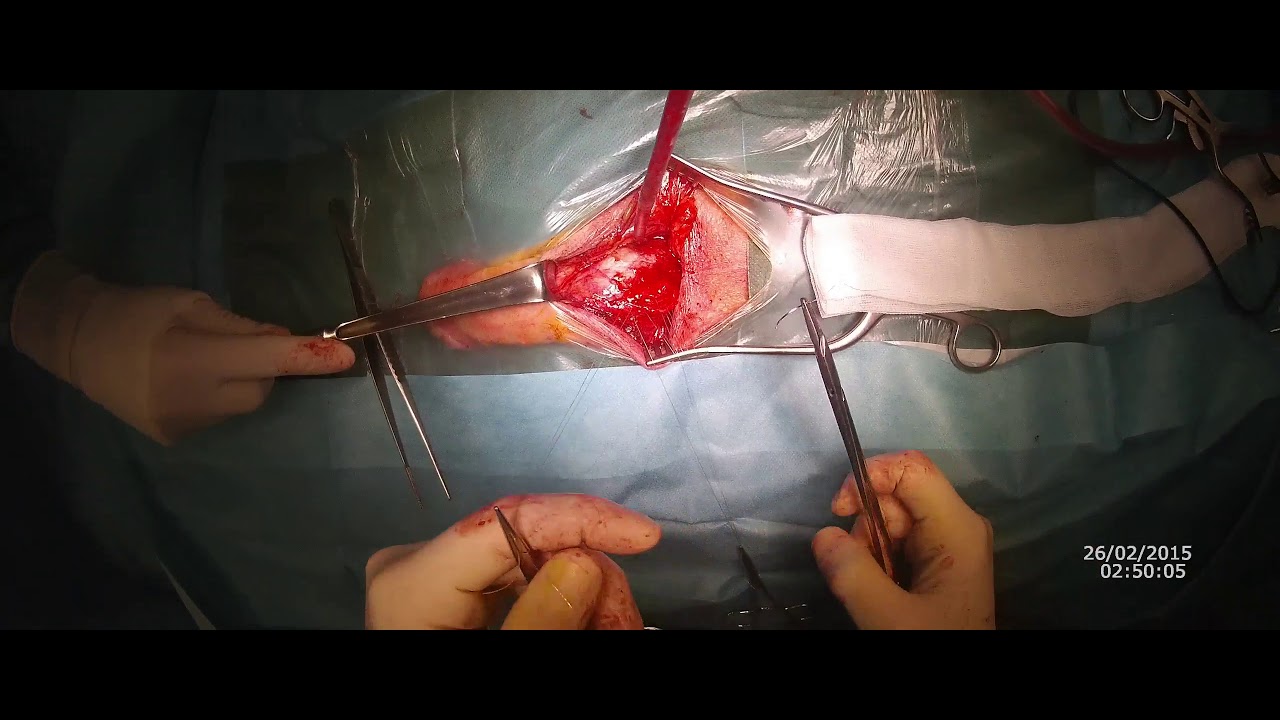 Pier Andrea Della Camera-82