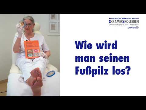 So werdet ihr euren Fußpilz los.