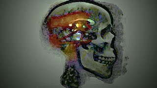 Massive Attack - Psyche A4=432Hz