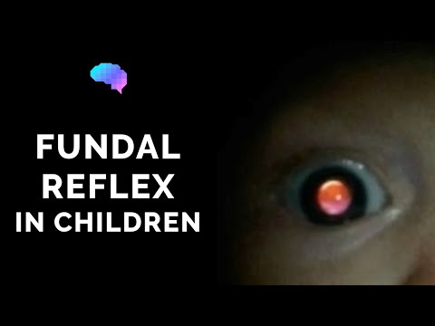 Fundal Reflex (a.k.a. Red Reflex) Assessment in Children - OSCE Guide | UKMLA | CPSA | PLAB 2
