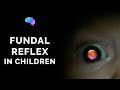 Fundal Reflex (a.k.a. Red Reflex) Assessment in Children - OSCE Guide | UKMLA | CPSA
