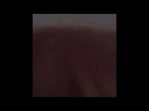 02. Contact Lens - SUV MINI MIX