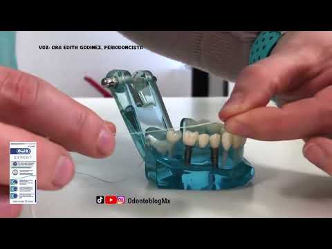 Uso de Hilo Dental Oral-B Superfloss