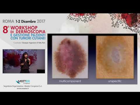 dopo il trattamento con radiazioni per il cancro alla prostata