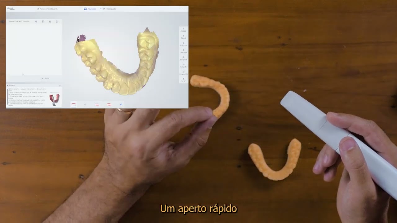 Vídeo 20 - Como realizar escaneamento Orotodôntico