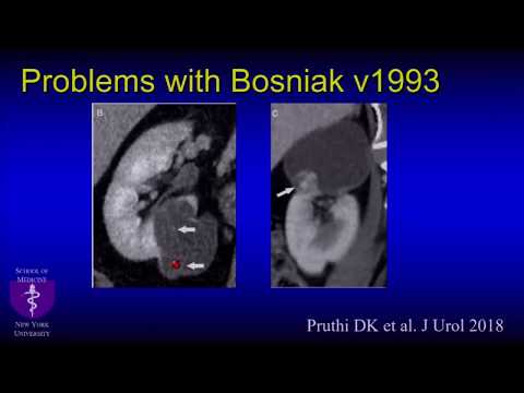 Revising the Bosniak Classification-- Nicole Hindman, MD (SABI 42nd Annual Course)