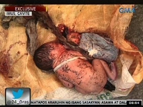 Kaysa sa paggamot ng kuko halamang-singaw at paa Tratuhin ang mga halamang-singaw sa kanyang mga paa review