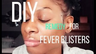DIY REMEDY FOR FEVER BLISTERS | smileychanae