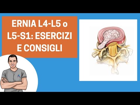 Dolori articolari sciatico Capsula articolare