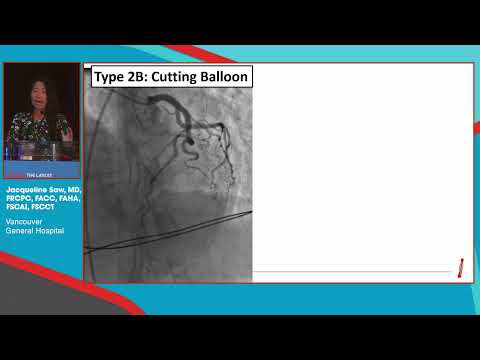 Jacqueline Saw, MD - Case-based presentation: SCAD