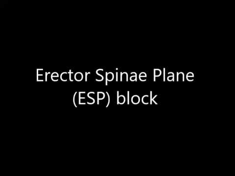 "How To Do It" - Ultrasound-guided erector spinae plane (ESP) block