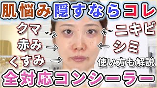【激推し】肌悩み隠したいならコレ!おすすめコンシーラー紹介!