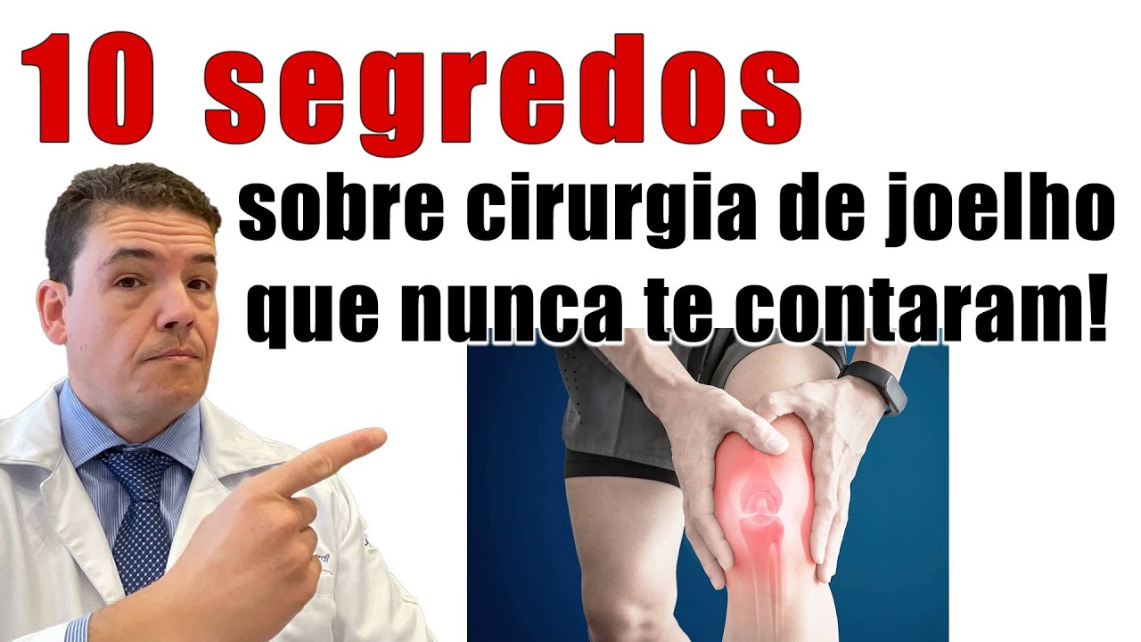 10 SEGREDOS SOBRE OPERAÇÃO NO JOELHO QUE NUNCA TE CONTARAM - Você vai se surpreender com o último.