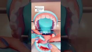 ASMR Applying Your Braces | DENTIST ROLEPLAY #Shorts