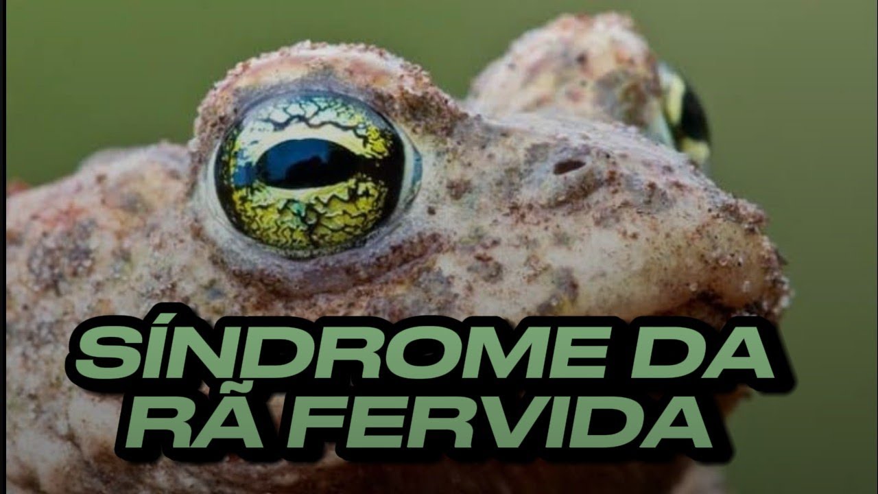 55. Síndrome da rã fervida 🐸