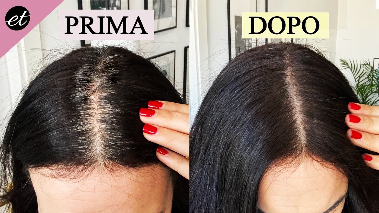 Watch Now ADDIO capelli bianchi in 3 minuti: NUOVO TRUCCHETTO FAI DA TE ADDIO capelli bianchi in 3 minuti: NUOVO TRUCCHETTO FAI DA TE