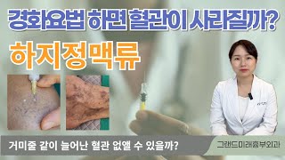 실핏줄 제거 시술(혈관경화요법)