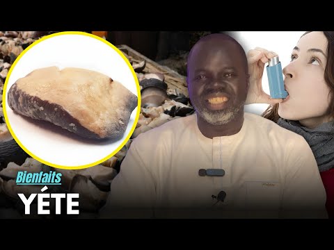 Ndiariniou Yéte ( Bienfaits Du Yette ) - Pr Ousmane Ndiaye - SAMA XALAA TV