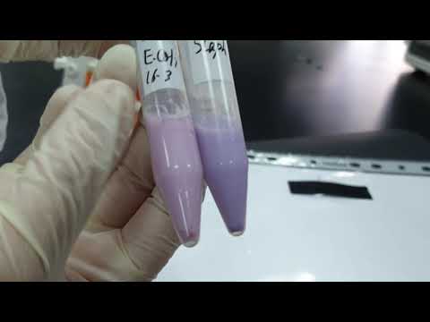 Gelatine hydrosysis and litmus milk test  Results