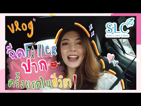 ฉีด ฟิลเลอร์ ปาก