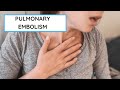 What Is A Pulmonary Embolism All You Need To Know