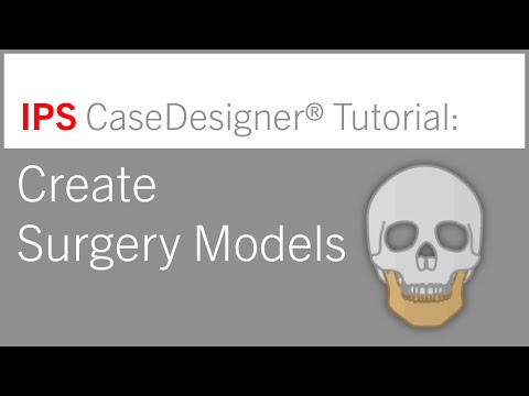 Workflow 2 – Create Surgery Models | IPS CaseDesigner® Tutorial