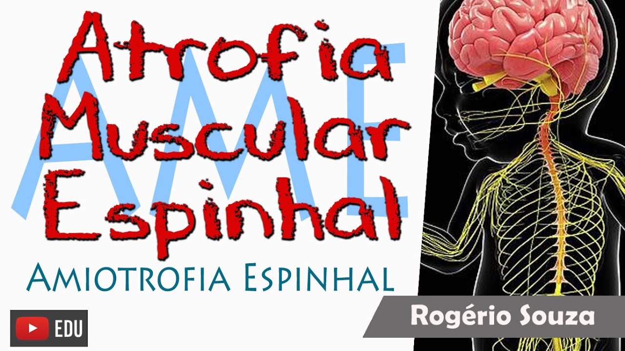 AME - ATROFIA MUSCULAR ESPINHAL (Aula Completa) - Rogério Souza
