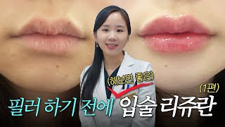 EDITION TV - 입술 리쥬란으로 겨울철 입술 건강 관리해 보세요!