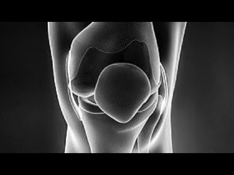 hogyan kezeljük az ízületek osteochondrozisában fellépő fájdalmat