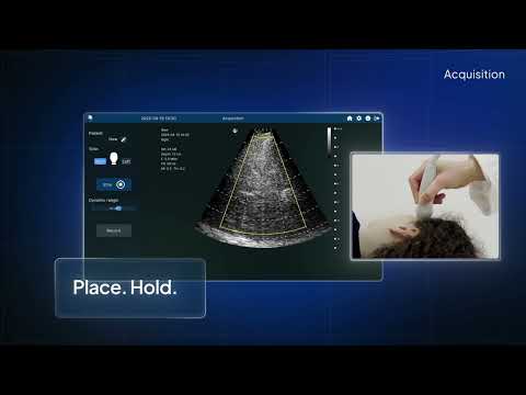 Aritz Zamacola, Resolve Stroke - AI-enabled bedside ultrasound for brain perfusion | LSI USA '26