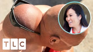 &quot;You Have Got A Head Behind Your Head!&quot; | Dr. Pimple Popper: Before The Pop