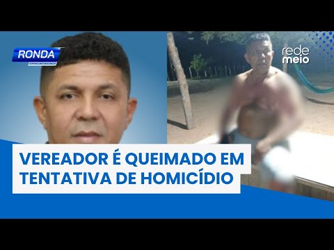 Vereador é queimado em tentativa de homicídio em Coivaras | Ronda