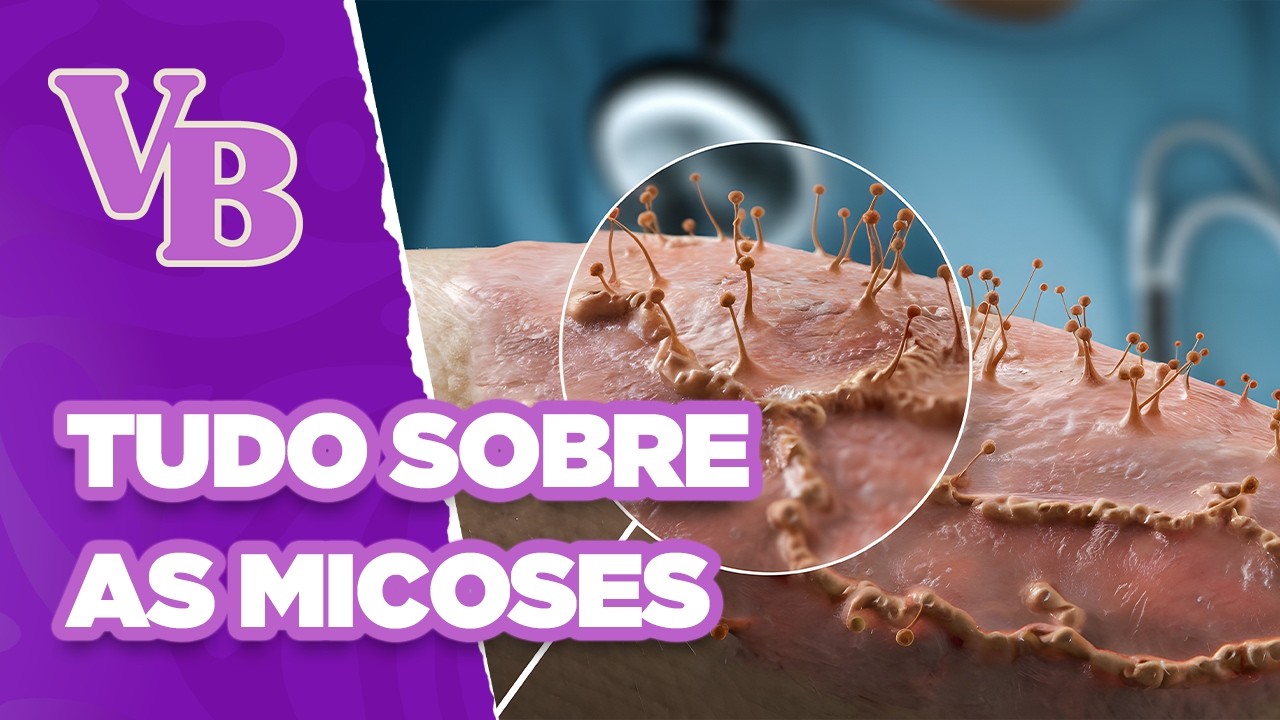 Tudo sobre MICOSE, tipos, causas e tratamentos. - Você Bonita (01/05/2025)