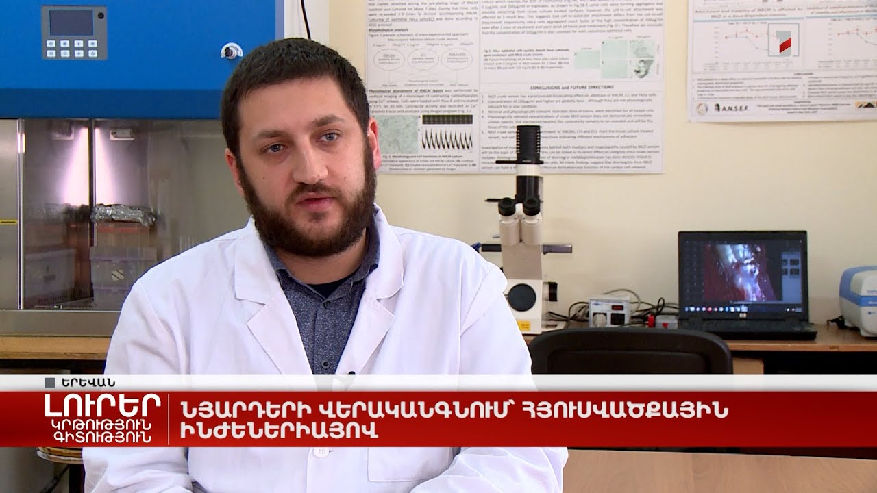 Նյարդերի վերականգնում՝ հյուսվածքային ինժեներիայով