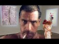 Deadbeat Hunter Biden playing 'starving artist' to Reduce Child Support