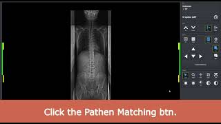 How to Stitch images in VXvue