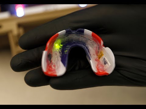Concussions: Stanford researchers use high-tech mouth guards to study head trauma