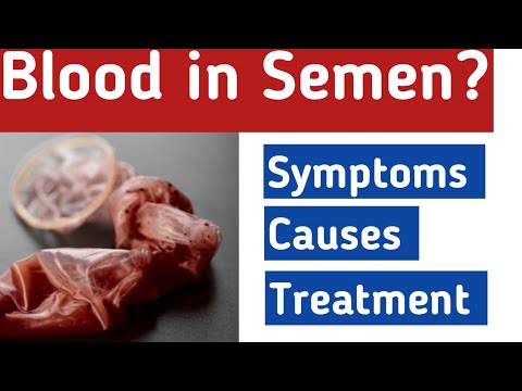Blood In semen (Haematospermia) - Causes, Symptoms, Diagnosis, Treatment  | Dr. Khalil Ur Rehman