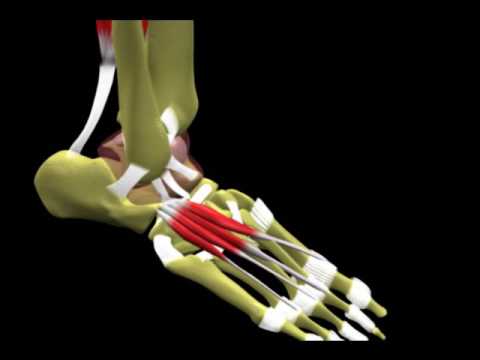 Síndromes de impacto