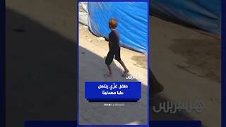 طفل غزّي يستخدم علبا معدنية كبديل عن الحذاء thumbnail