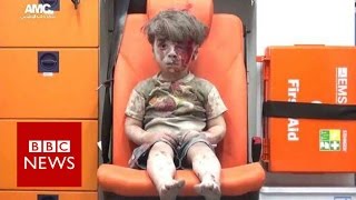 "Omran is a lucky child" BBC News