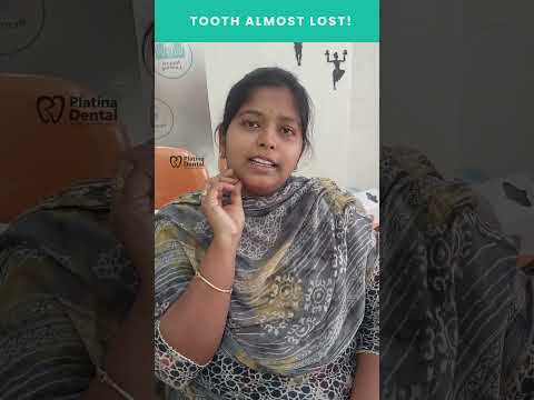 Painless Laser Root Canal