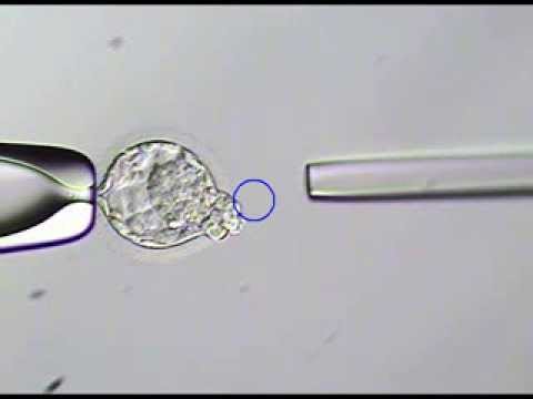 Embryo Biopsy 