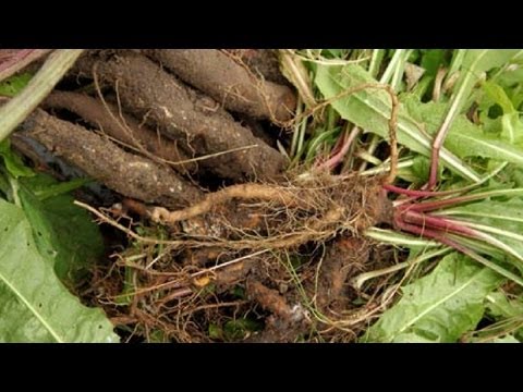 Суставы кости анатомия Болит шея от позвоночных грыж